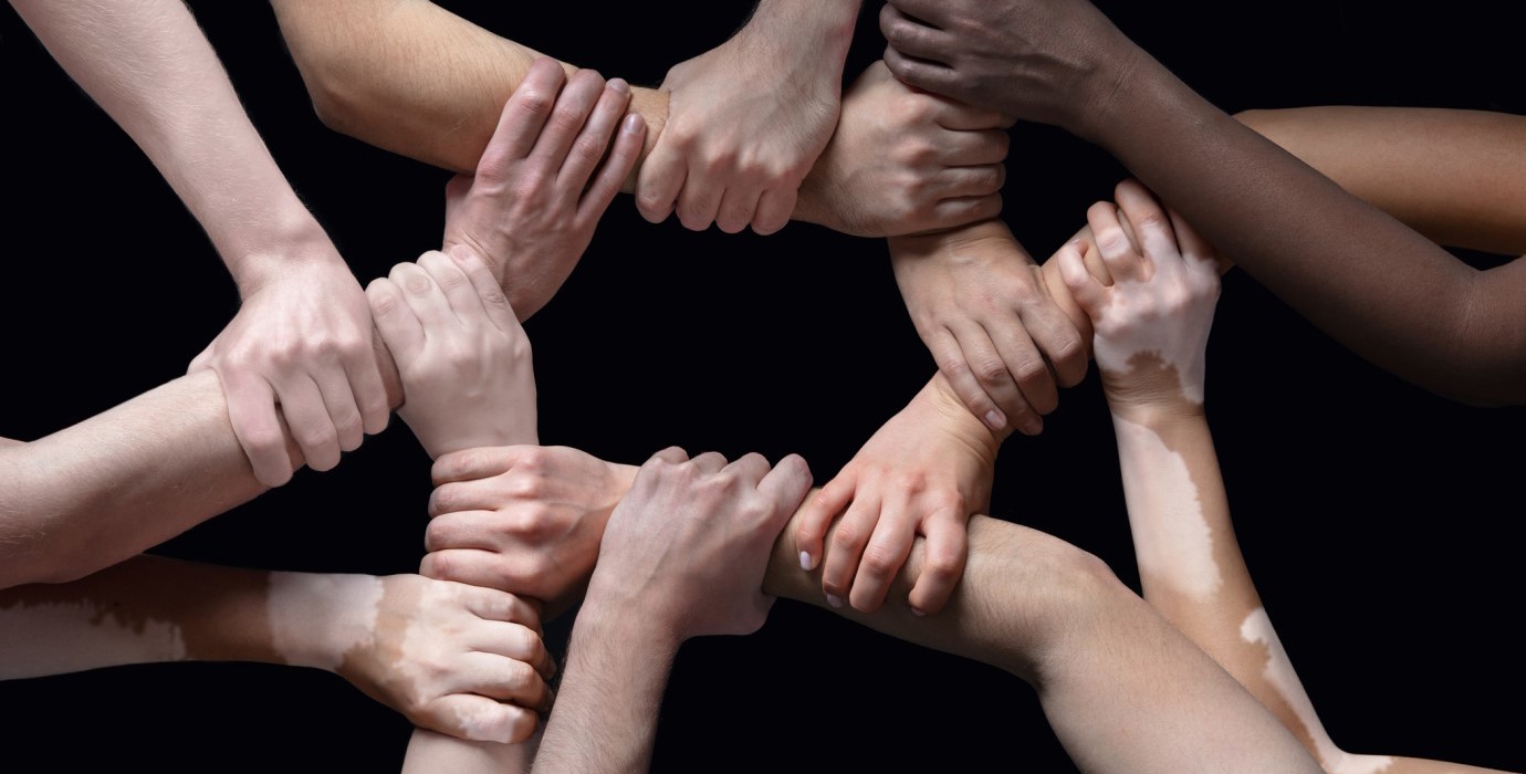 arms linked together for teamwork
